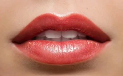 Revolucionando el Aumento de Labios: La Vanguardia de la Aparatología Estética