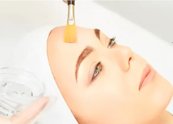 Peeling químico: Tecnología avanzada para renovar la piel